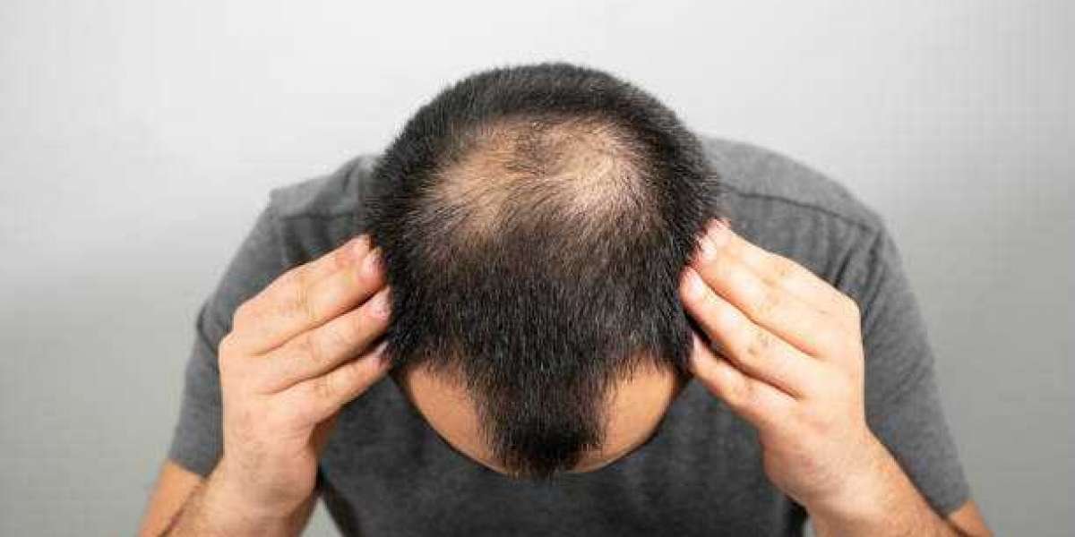 Discovering the Best Hair Transplant Clinic in Dubai: A Comprehensive Guide