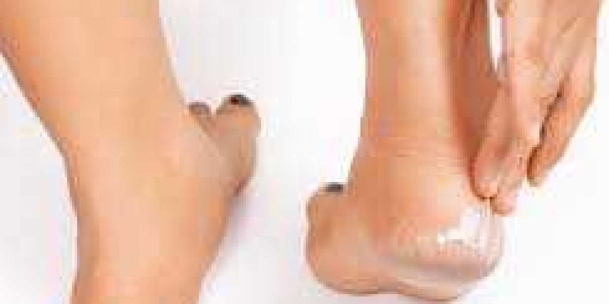 Best Cooling Foot Cream: A Soothing Solution for Tired Feet