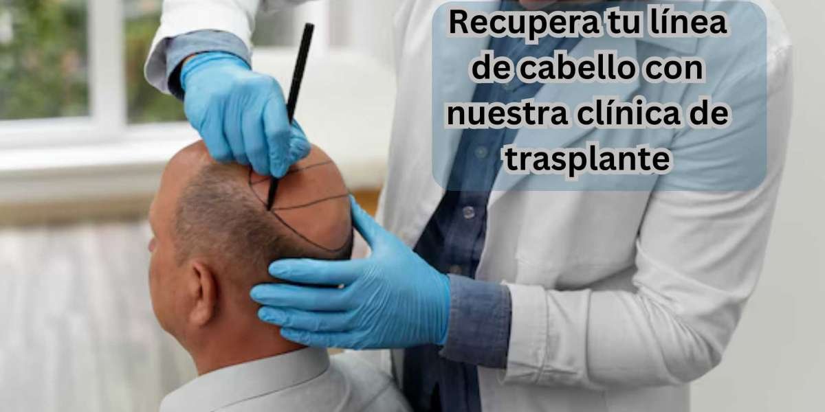 Recupera tu línea de cabello con nuestra clínica de trasplante